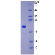 SDS-PAGE analysis of Human Adiponectin Protein.