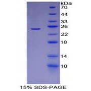 SDS-PAGE analysis of Human ADRP Protein.