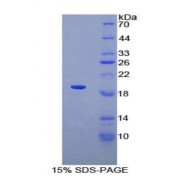 SDS-PAGE analysis of Human ADRA1A Protein.