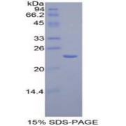 SDS-PAGE analysis of Mouse AGER Protein.