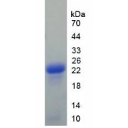 SDS-PAGE analysis of recombinant Human Afamin Protein.