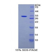 SDS-PAGE analysis of Rat Alanine Aminopeptidase Protein.