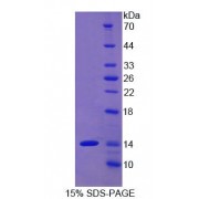 SDS-PAGE analysis of recombinant Human Alanine Aminotransferase (ALT) Protein.