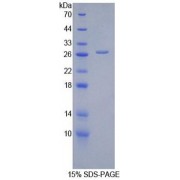 SDS-PAGE analysis of recombinant Human Alanine Aminotransferase 1 (GPT) Protein.