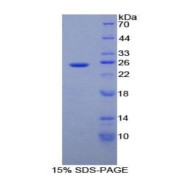 SDS-PAGE analysis of recombinant Human ADH1 Protein.