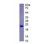 SDS-PAGE analysis of recombinant Human Aldehyde Dehydrogenase, Mitochondrial (ALDM) Protein.