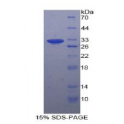 SDS-PAGE analysis of Human ALDOA Protein.