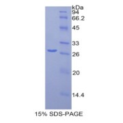 SDS-PAGE analysis of Mouse Orosomucoid 1 Protein.