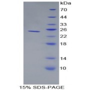 SDS-PAGE analysis of recombinant Rat Alpha-1-Acid Glycoprotein.