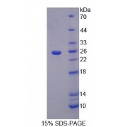 SDS-PAGE analysis of Human alpha 1-B-GlycoProtein.