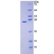 SDS-PAGE analysis of AMBP Protein.