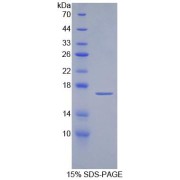 SDS-PAGE analysis of Human aZGP1 Protein.
