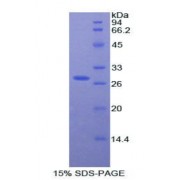 SDS-PAGE analysis of recombinant Rat AHSG Protein.