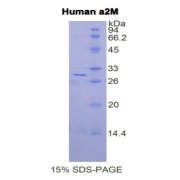 SDS-PAGE analysis of Human alpha 2-Macroglobulin Protein.