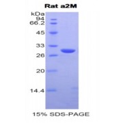 SDS-PAGE analysis of Rat alpha 2-Macroglobulin Protein.