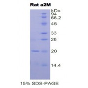 SDS-PAGE analysis of Rat alpha 2-Macroglobulin Protein.
