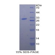 SDS-PAGE analysis of Human a2ML1 Protein.