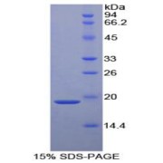 SDS-PAGE analysis of Human SERPINF2 Protein.