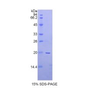 SDS-PAGE analysis of Rat a2PI Protein.