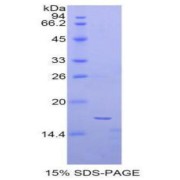 SDS-PAGE analysis of Human AFP Protein.
