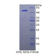 SDS-PAGE analysis of Rat AFP Protein.