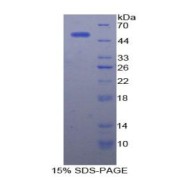 SDS-PAGE analysis of Rat AFP Protein.