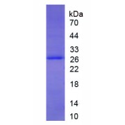 SDS-PAGE analysis of Human AFP Protein.
