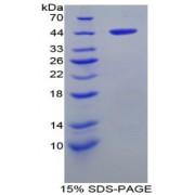 SDS-PAGE analysis of Rat aHSP Protein.