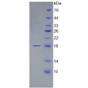 SDS-PAGE analysis of Mouse APP Protein.