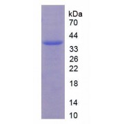 SDS-PAGE analysis of Human Androgen Receptor Protein.