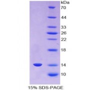 SDS-PAGE analysis of Human AGGF1 Protein.