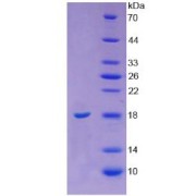 abx065305
