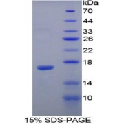 abx065309