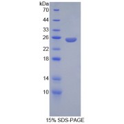SDS-PAGE analysis of recombinant Rat Angiopoietin 2 Protein.