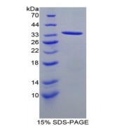 SDS-PAGE analysis of Rat ANGPTL1 Protein.