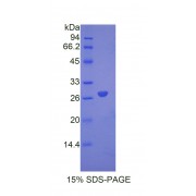 SDS-PAGE analysis of Mouse ANGPTL6 Protein.