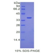 abx065342