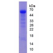 SDS-PAGE analysis of Human ACE Protein.