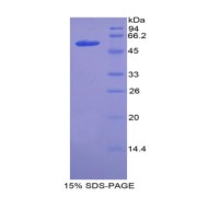 SDS-PAGE analysis of Mouse ACE Protein.