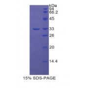 SDS-PAGE analysis of Human AST Protein.