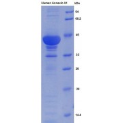 SDS-PAGE analysis of Human Annexin A1 Protein.