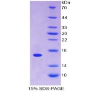 SDS-PAGE analysis of Human Annexin A3 Protein.