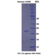 SDS-PAGE analysis of Human AGR2 Protein.