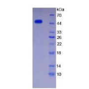 SDS-PAGE analysis of Human Thrombin Protein.