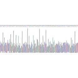 Human Apelin (APLN) Protein