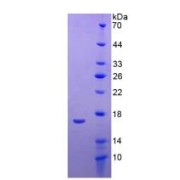 abx065398