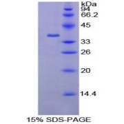 abx065440