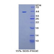 SDS-PAGE analysis of Human AQP2 Protein.