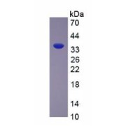 SDS-PAGE analysis of recombinant Rat Arginase Protein.