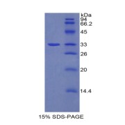 abx065465